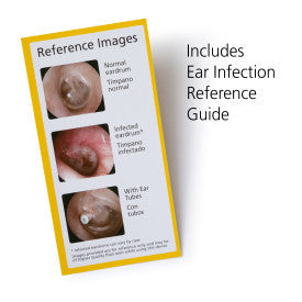 Safety 1ˢᵗ Ear Otoscope