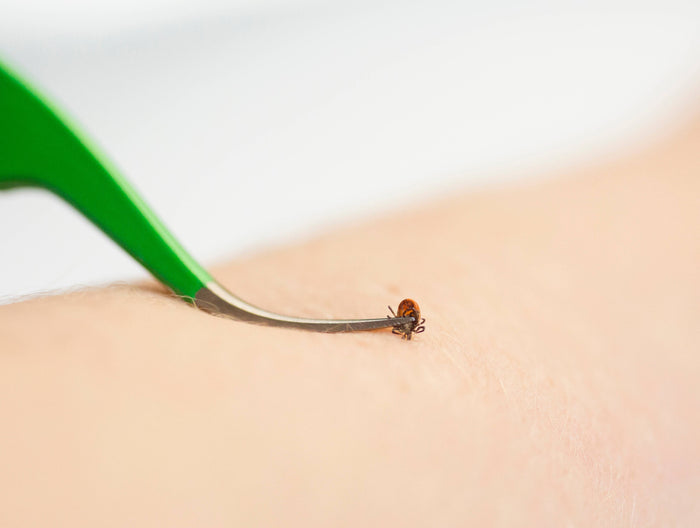 TickCheck Premium Tick Remover Kit